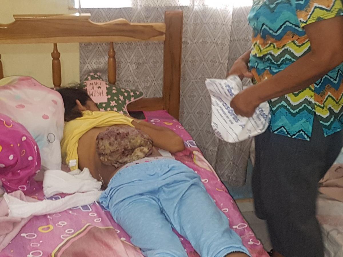 Andrea en su casa en Panamá, cuando había sido deshauciada médicamente por el tumor en su espalda.
