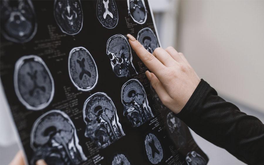 Cada año se diagnostican en España unos 40.000 nuevos casos de alzhéimer. Cada año se diagnostican en España unos 40.000 nuevos casos de alzhéimer.